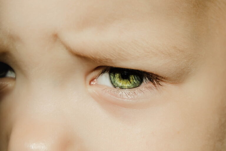 Retinopathy of Prematurity and Medical Malpractice Claims