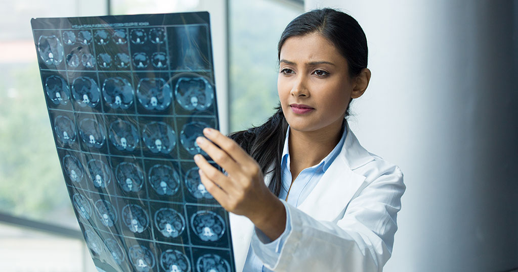 Brain Injury Claims