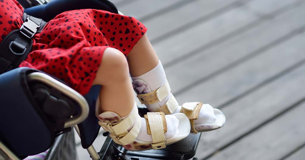 cerebral palsy in babies
